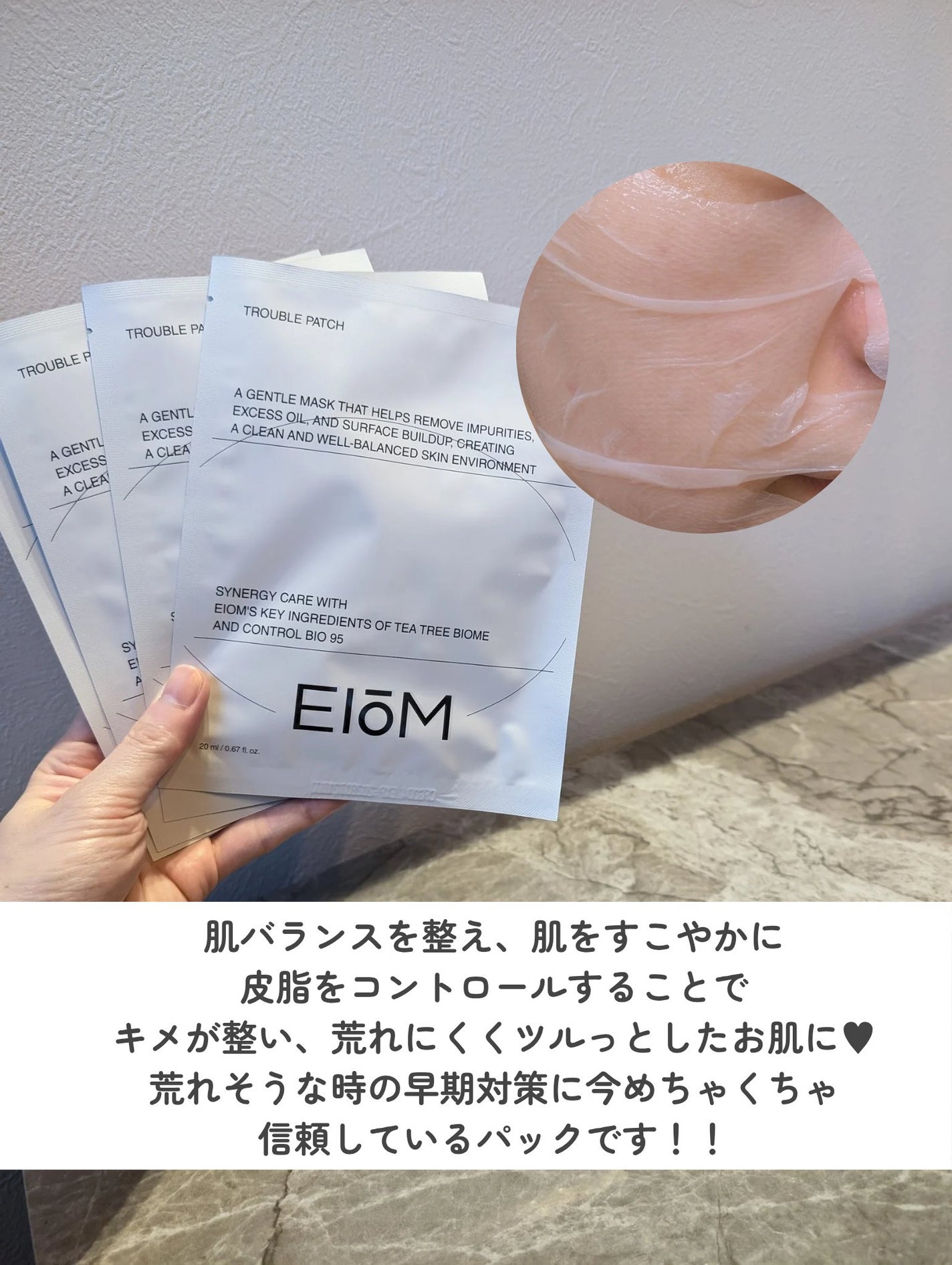 トラブルパッチマスク/EIOM/その他スキンケアを使ったクチコミ(4枚目)