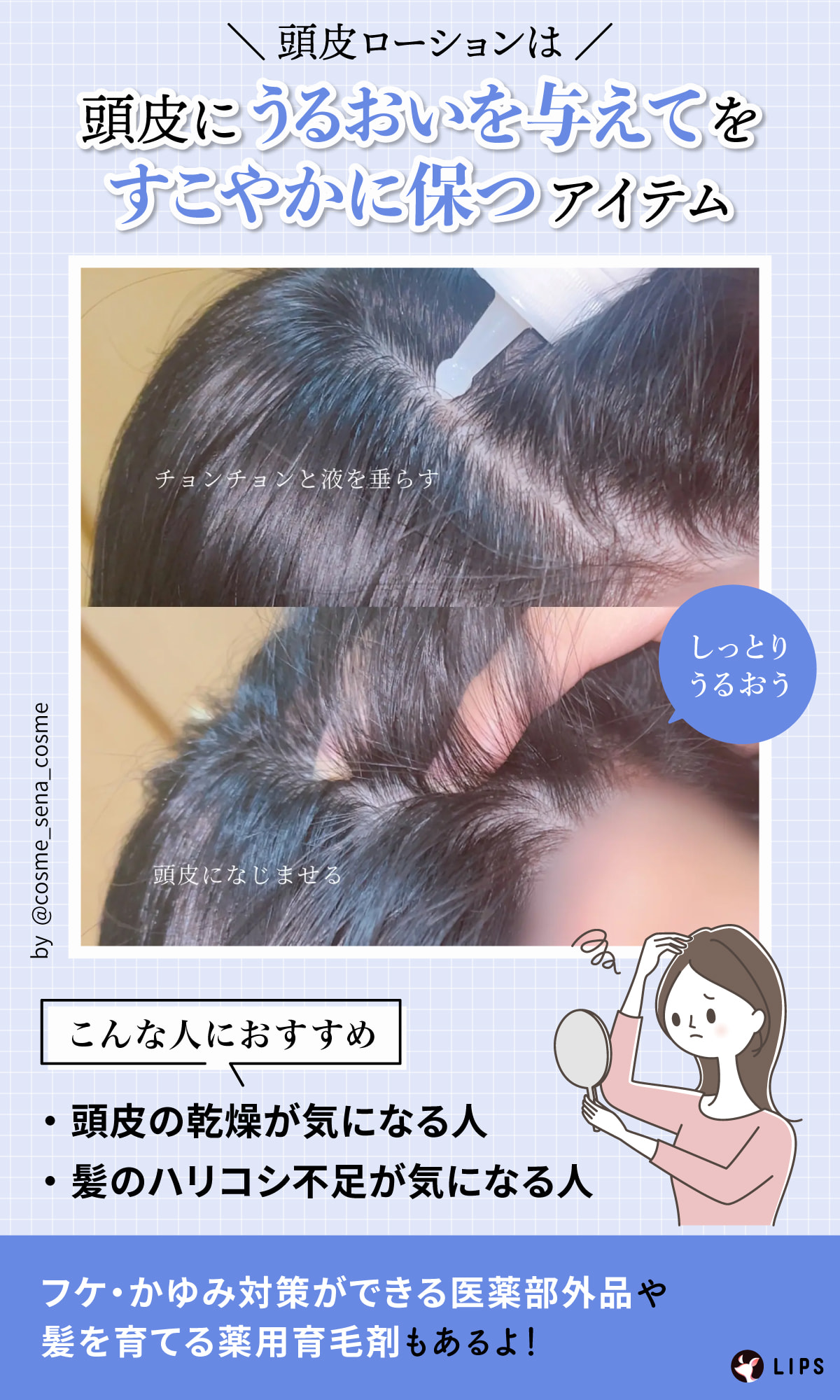 頭皮ローションは頭皮にうるおいを与えてすこやかに保つアイテム。頭皮の乾燥が気になる人・髪のハリコシ不足が気になる人におすすめ。フケ・かゆみ対策ができる医薬部外品や髪を育てる薬用育毛剤もあるよ！