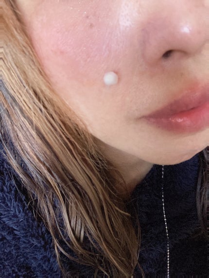 PDRN 1000 Plus Cream/Rejuveon/フェイスクリームを使ったクチコミ(4枚目)