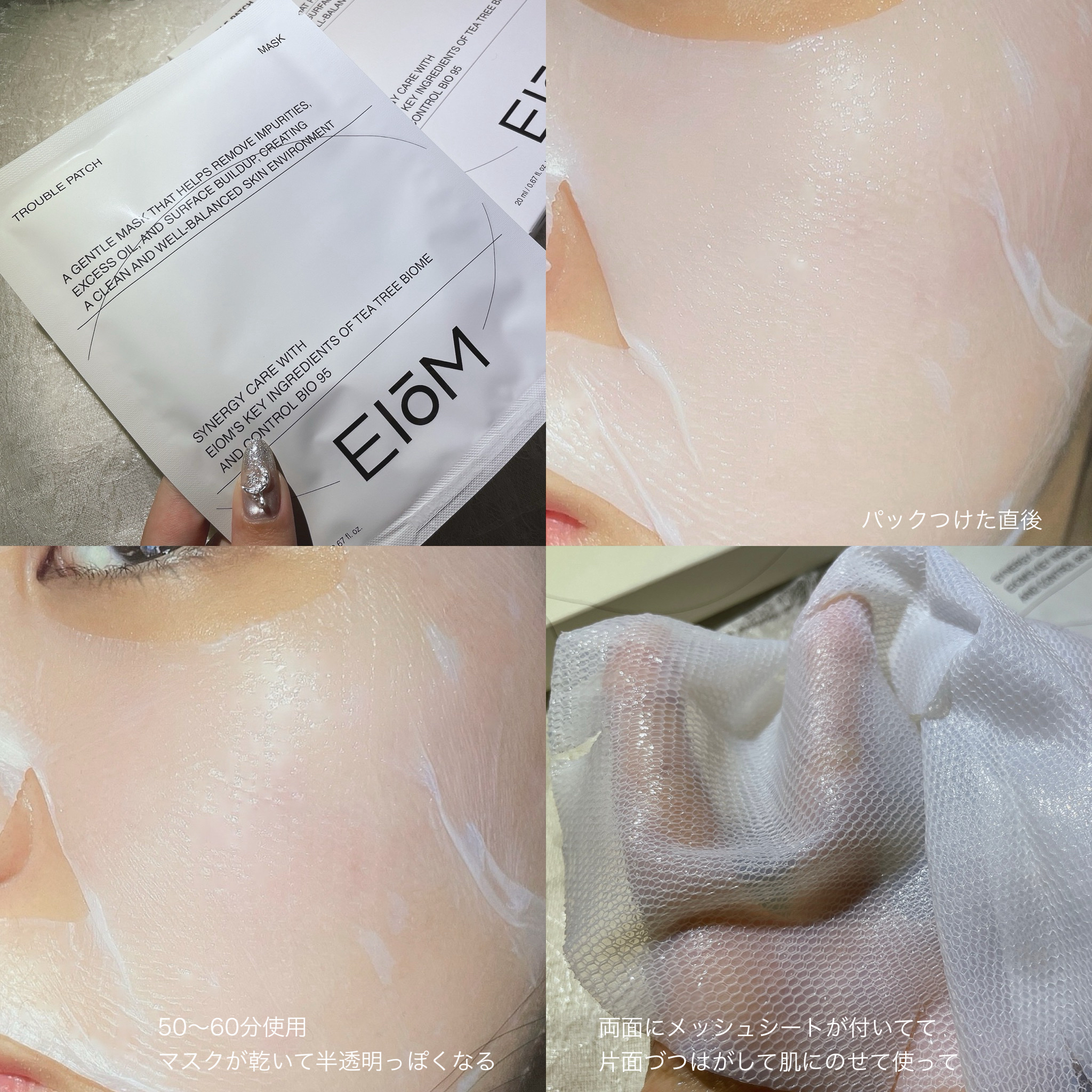 トラブルパッチマスク/EIOM/その他スキンケアを使ったクチコミ（3枚目）
