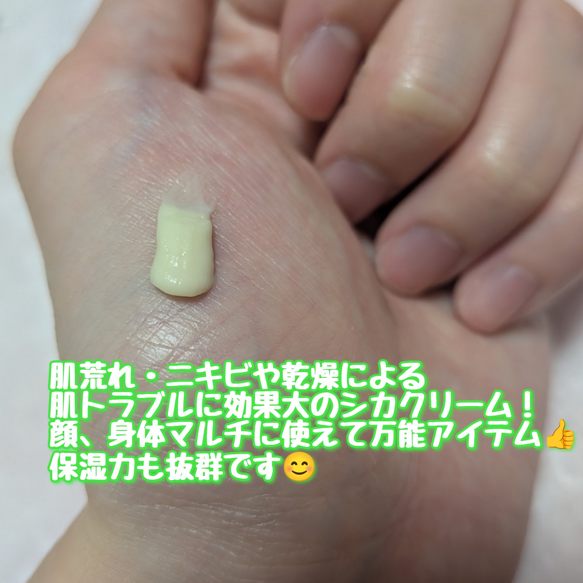 薬用CICAリペア クリーム/タイガレイド/フェイスクリームを使ったクチコミ（2枚目）