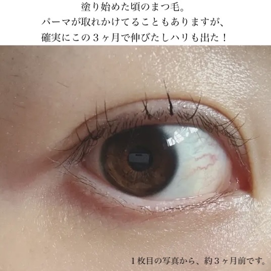 スカルプD アイラッシュセラム ピュア 6ml/アンファー(スカルプD)/まつげ美容液を使ったクチコミ（3枚目）