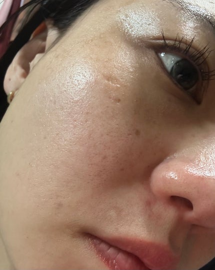 クラウドアンプル 1week キット/CHARDE/美容液を使ったクチコミ(2枚目)