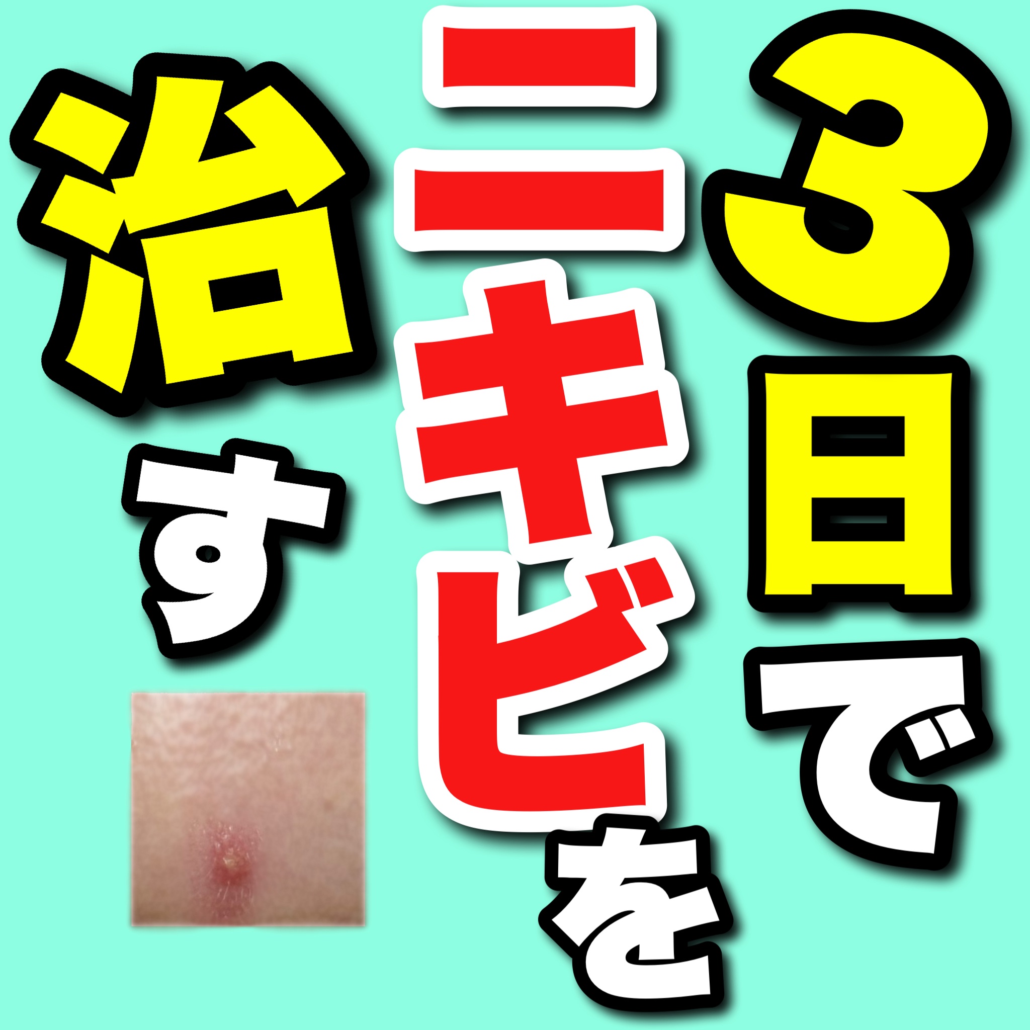 こんにちは🌞
ちょむです😆

今回は3日でニキビを治す方法を紹介します！

使ったコスメ等の商品情報です♪
👇👇👇

○o･ω･o○o･ω･o○*-*-*-*-*-*-○o･ω･o○o･ω･o○

●◯商品情報●◯

ブランド:オ