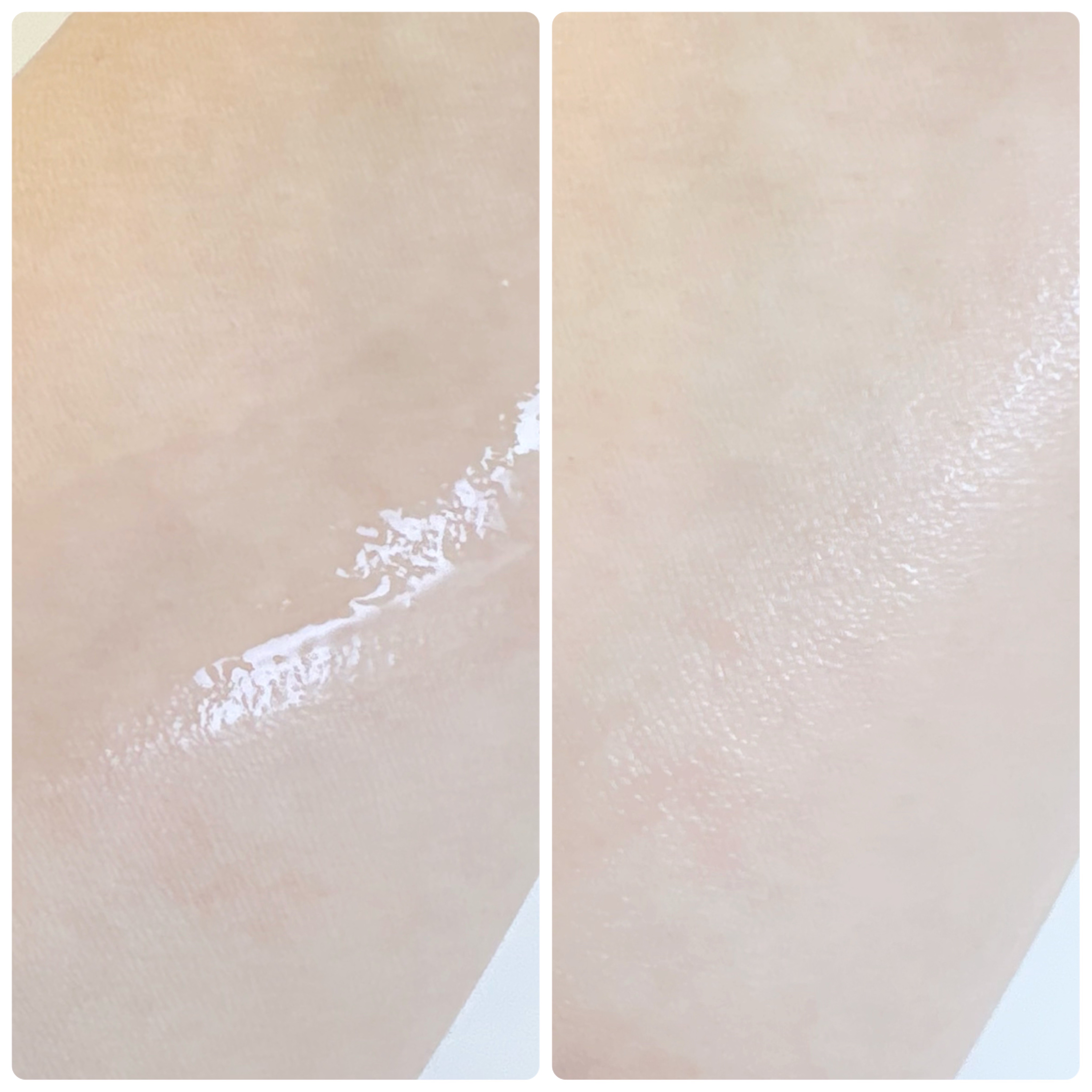 リフトホワイト ローション モイスト/BRIGHTAGE/化粧水を使ったクチコミ（3枚目）