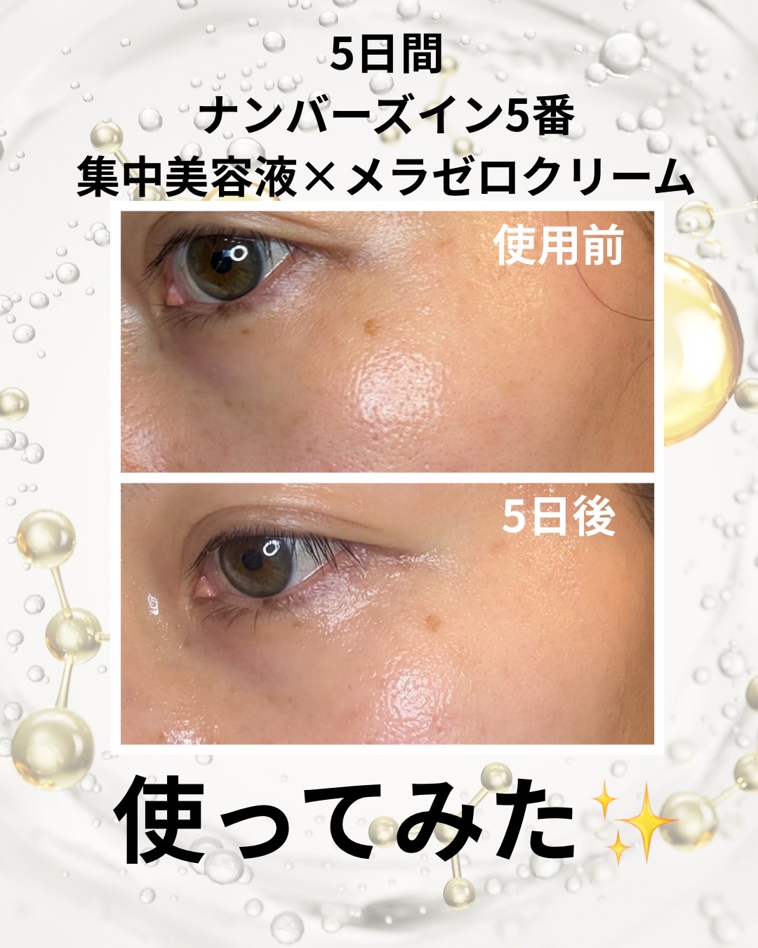 5番 白玉グルタチオンCメラゼロクリーム/numbuzin/フェイスクリームを使ったクチコミ（2枚目）