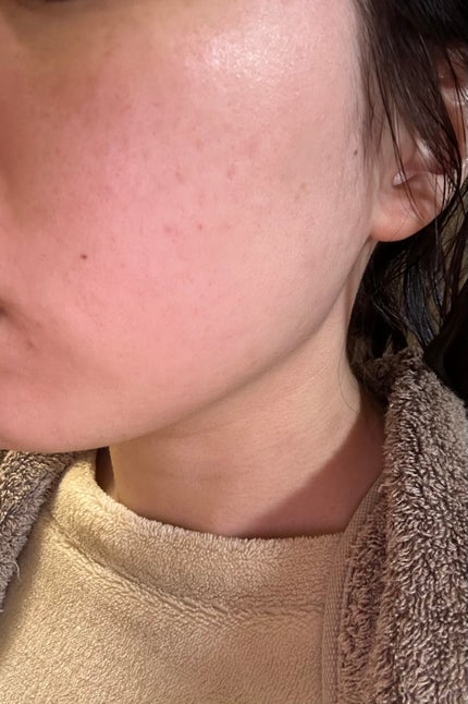 グリーンダーマCICA デイリーシートマスク/ネイチャーリパブリック/シートマスク・パックを使ったクチコミ(4枚目)