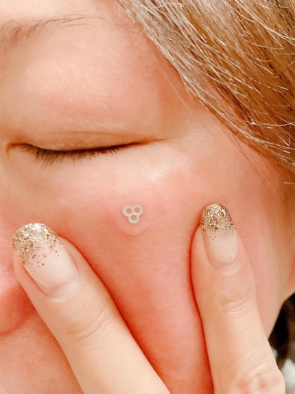 ACマグネシウムパッチ/スノーツープラス/シートマスク・パックを使ったクチコミ(3枚目)