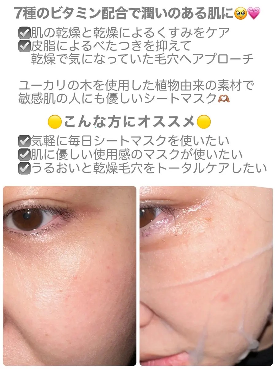 ビタミンC(*⁶)パンテノールマスク/MIJIN COSMETICS/シートマスク・パックを使ったクチコミ（2枚目）