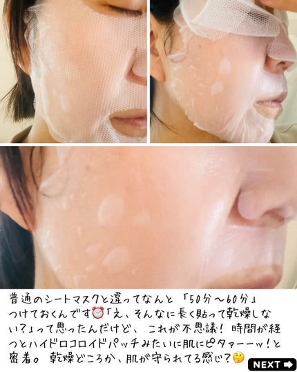 えむEMU美容編集部 on LIPS 「こんばんはemuですえっ、自分の毛穴汚れが目に見える!?😱💦ち..」(4枚目)