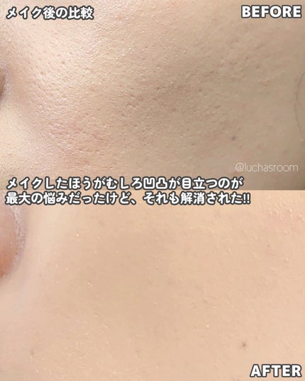 トリア・スキン エイジングケアレーザー/トリア/美顔器・マッサージを使ったクチコミ(3枚目)