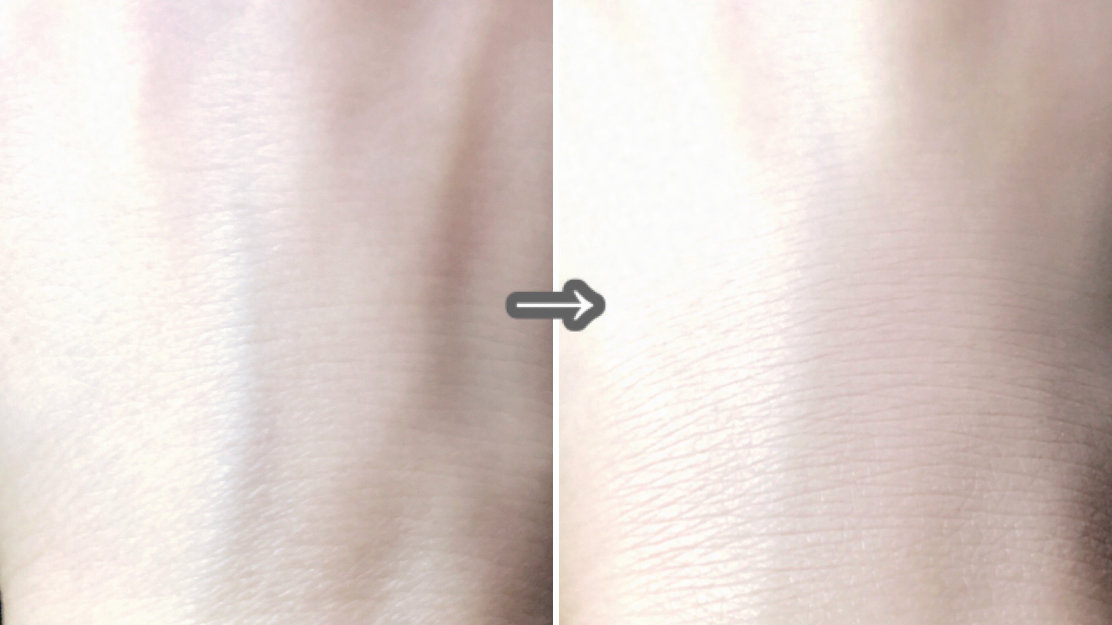 アイシーフィットカバークッションEX/TFIT/クッションファンデーションを使ったクチコミ（3枚目）