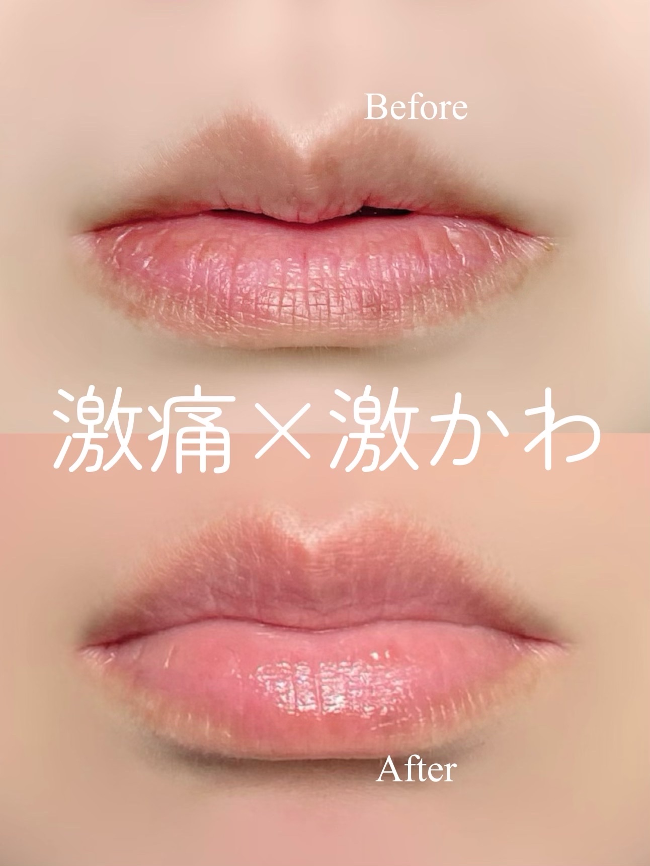 上級者向け！挑戦者求む！【激痛×激かわ】プランパー*

ただ痛いだけじゃない！
ケアも下地もこれ1本で叶う
 角質ケアもできるから
リップメイク前の仕込みにぴったり
 ケアx可愛さを同時に叶える2in1プランパー*

◆LoNLy／ロンリー