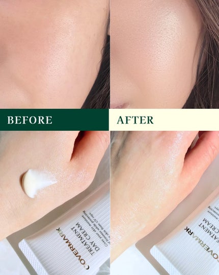 トリートメント デイ クリーム/COVERMARK/日焼け止めクリームを使ったクチコミ(4枚目)