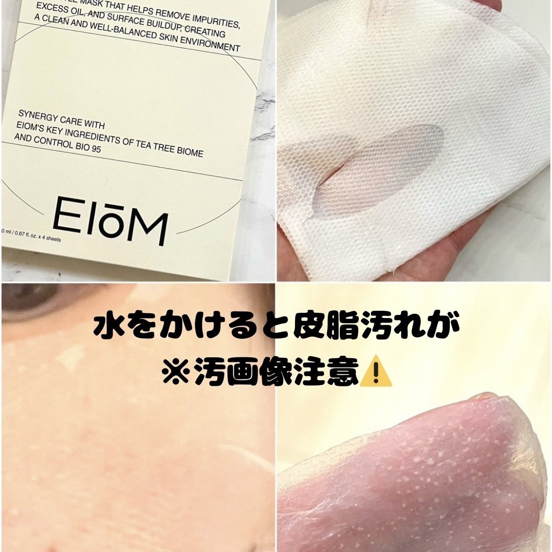 トラブルパッチマスク/EIOM/その他スキンケアを使ったクチコミ（3枚目）