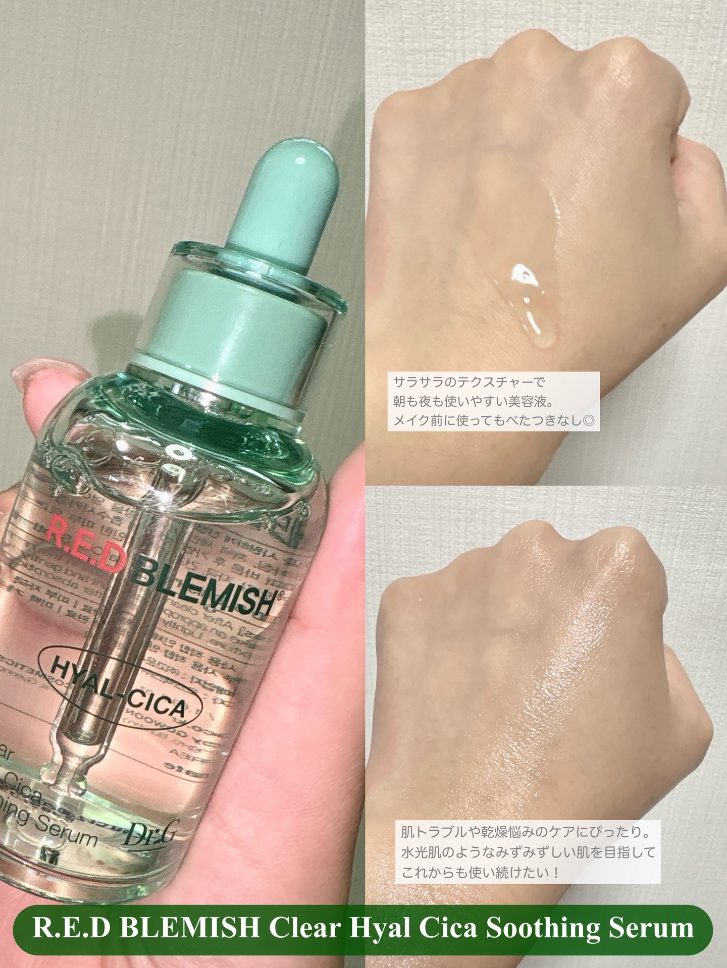 レッドブレミッシュ クリアスージングクリーム/Dr.G/フェイスクリームを使ったクチコミ（3枚目）