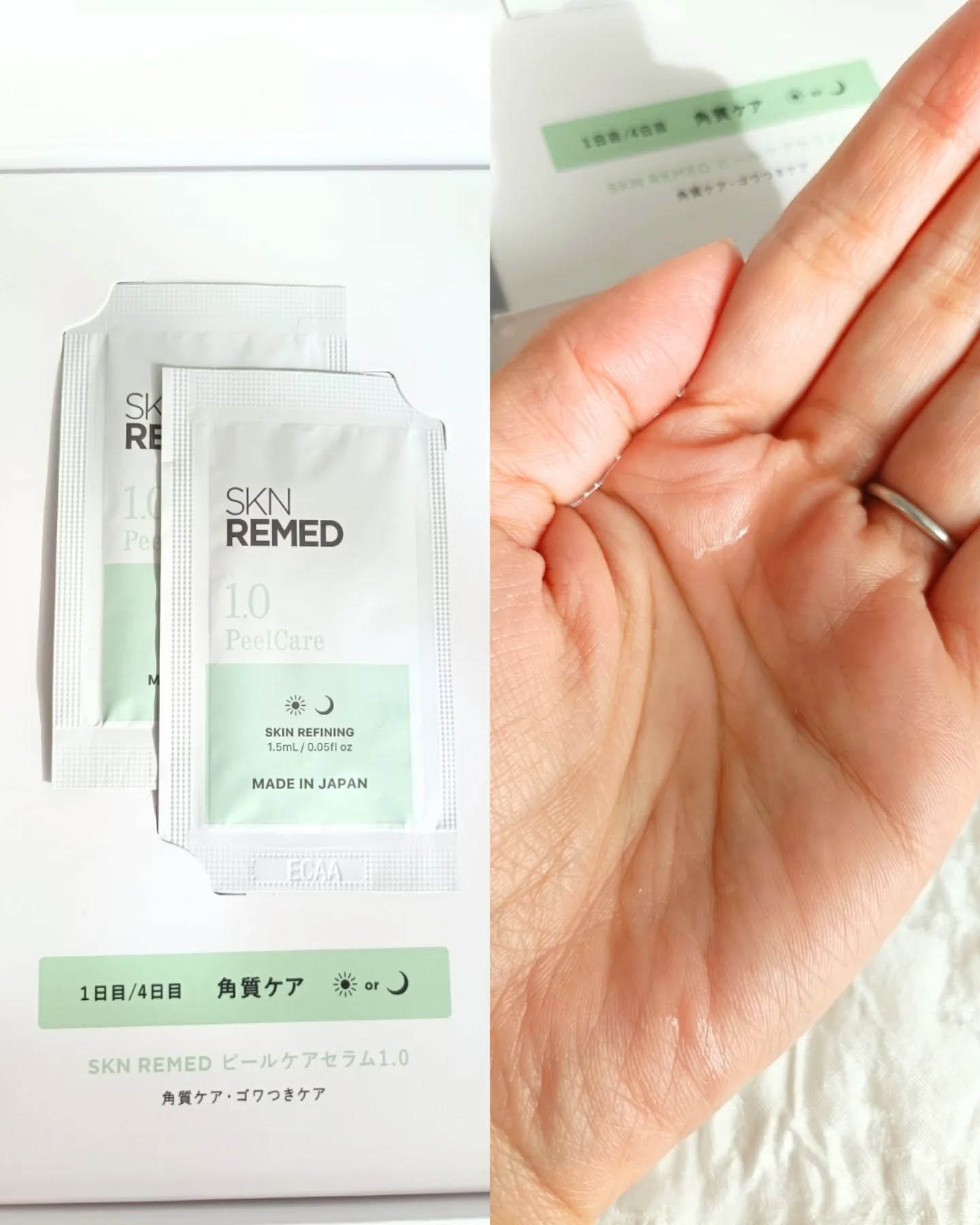 トライアルセット/SKN REMED/トライアルキットを使ったクチコミ（2枚目）