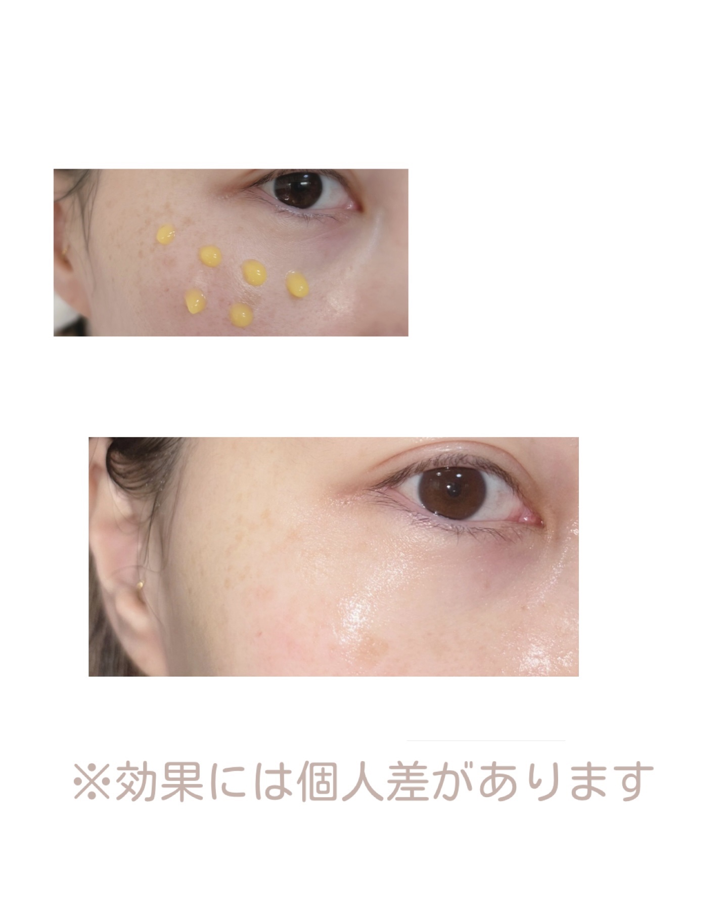 ビタミンCもちプレミアムセラム/アレンシア/美容液を使ったクチコミ（3枚目）