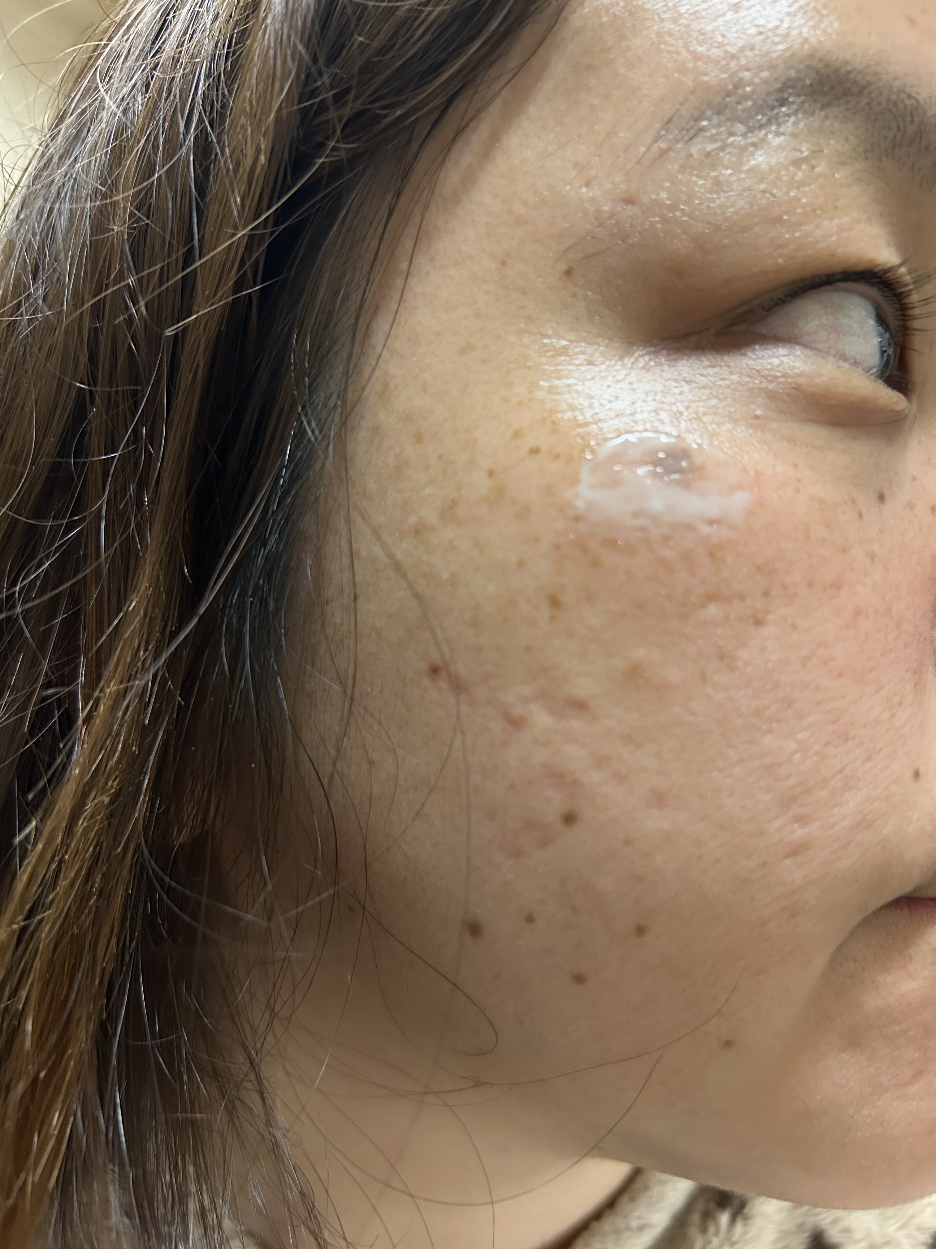 メラピールクリームマスク/CHARDE/ピーリングを使ったクチコミ（2枚目）