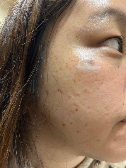 メラピールクリームマスク/CHARDE/ピーリングを使ったクチコミ(2枚目)