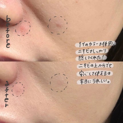 ダーマシンコンシーラー/23years old/リキッドコンシーラーを使ったクチコミ(3枚目)