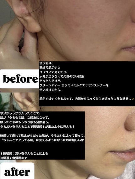 グリーンティー セラミド バリア クリーム/innisfree/フェイスクリームを使ったクチコミ(5枚目)