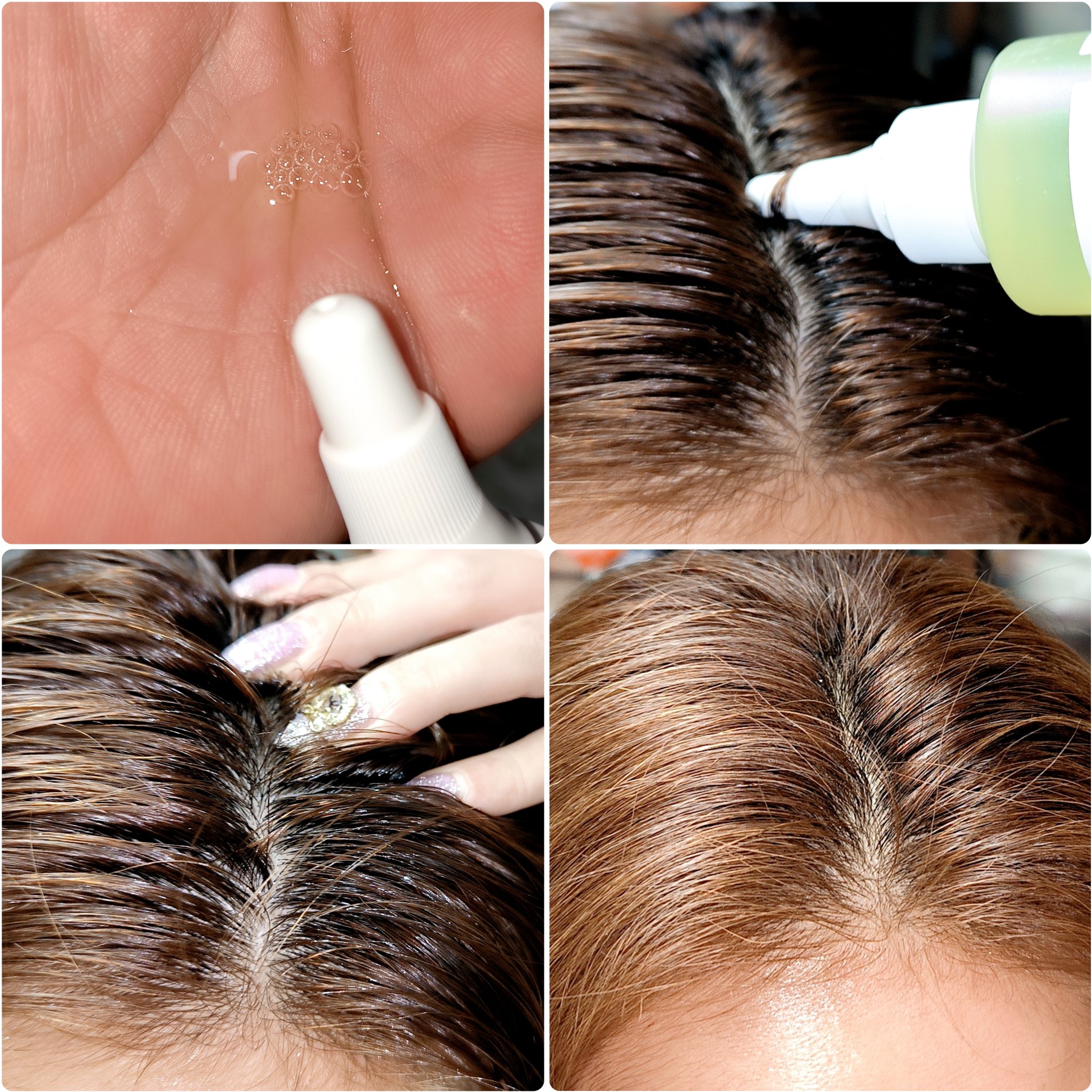 頭皮保湿ローション/Bloom Lift/頭皮ローションを使ったクチコミ（3枚目）