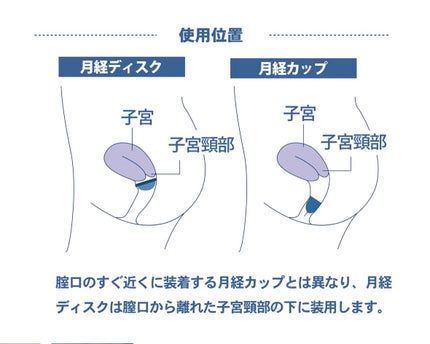 エアリズム吸水サニタリーショーツ/ユニクロ/その他生理用品を使ったクチコミ(3枚目)