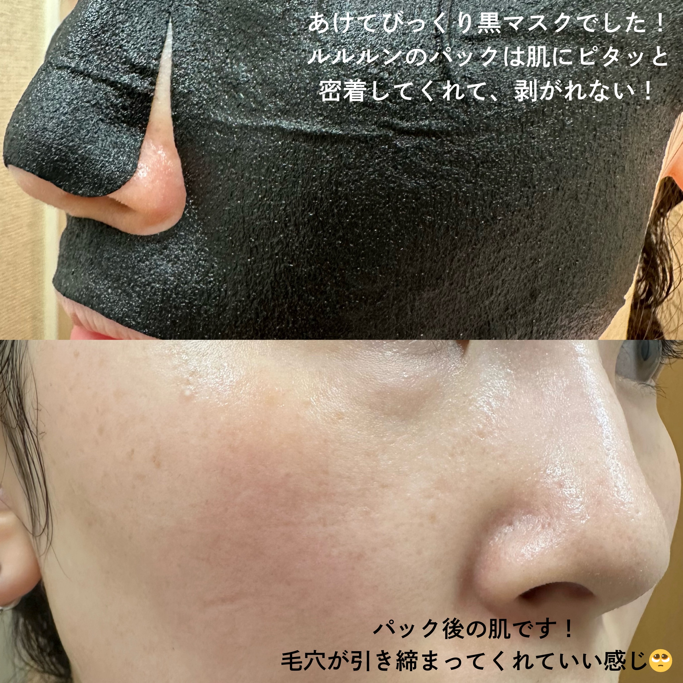 ルルルン ハイドラ F マスク/ルルルン/シートマスク・パックを使ったクチコミ（3枚目）