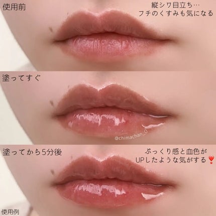 フレイムライトリッププランパー/LoNLy /リッププランパーを使ったクチコミ(2枚目)