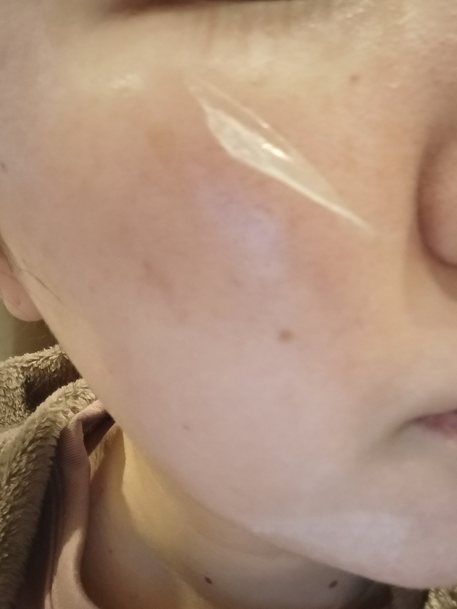 メラピールクリームマスク/CHARDE/ピーリングを使ったクチコミ（3枚目）