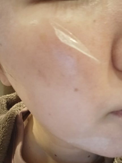 メラピールクリームマスク/CHARDE/ピーリングを使ったクチコミ(3枚目)