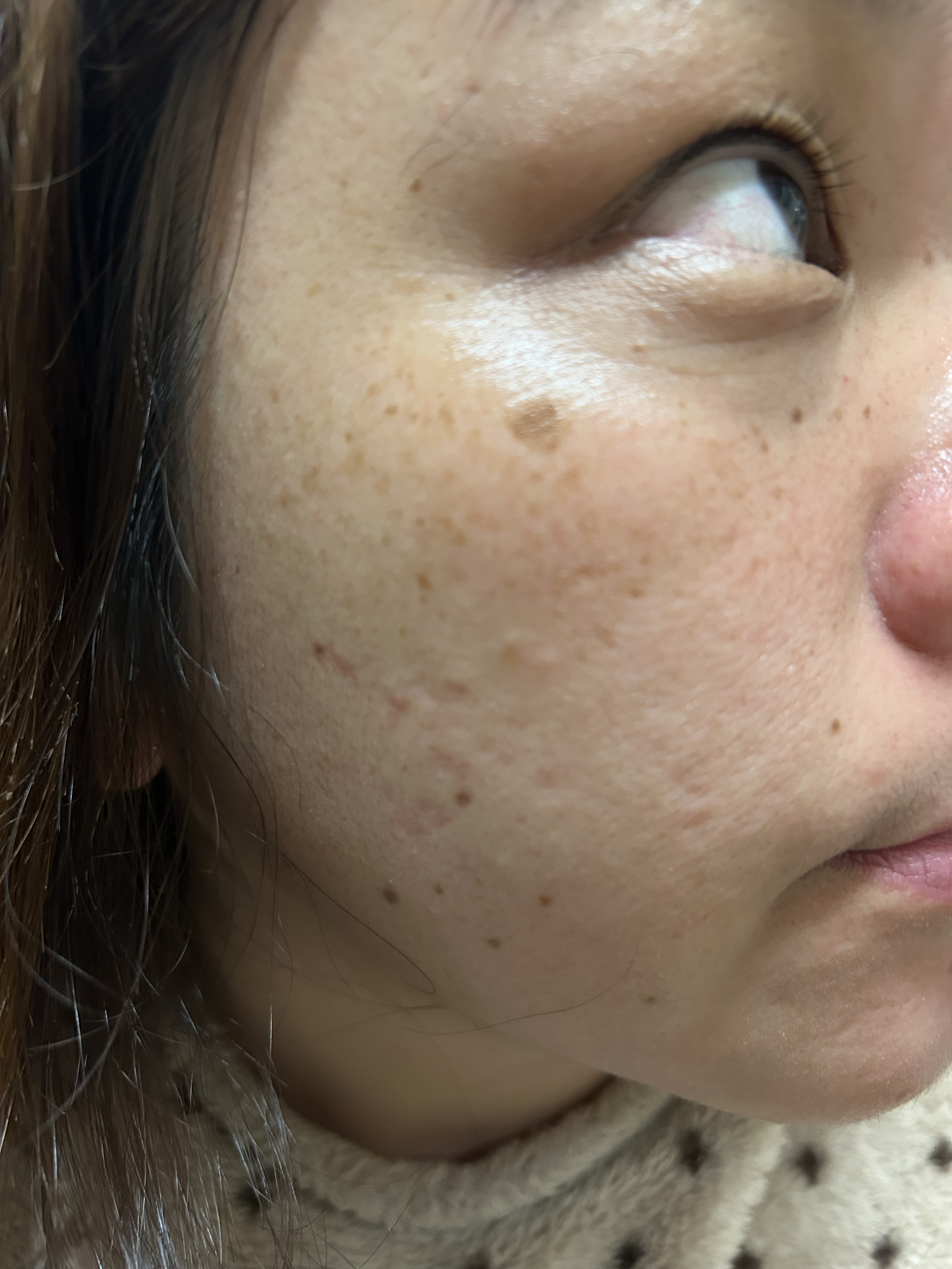 メラピールクリームマスク/CHARDE/ピーリングを使ったクチコミ（1枚目）