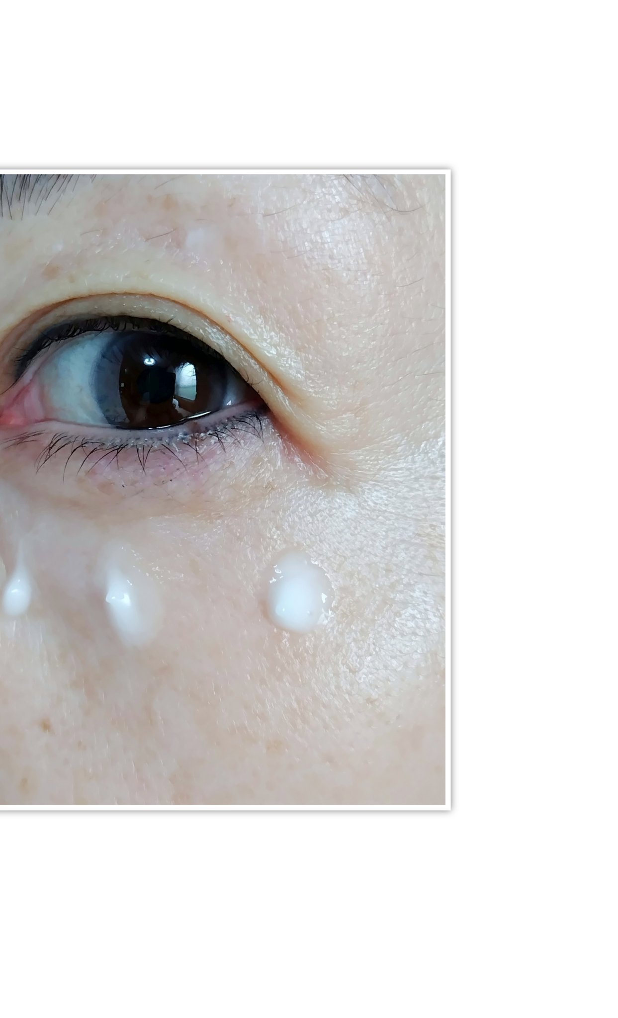 BAKUCHI NEEDLE SHOT DARK CARE AUTO EYE CREAM/LIALUSTER/アイケア・アイクリームを使ったクチコミ（3枚目）