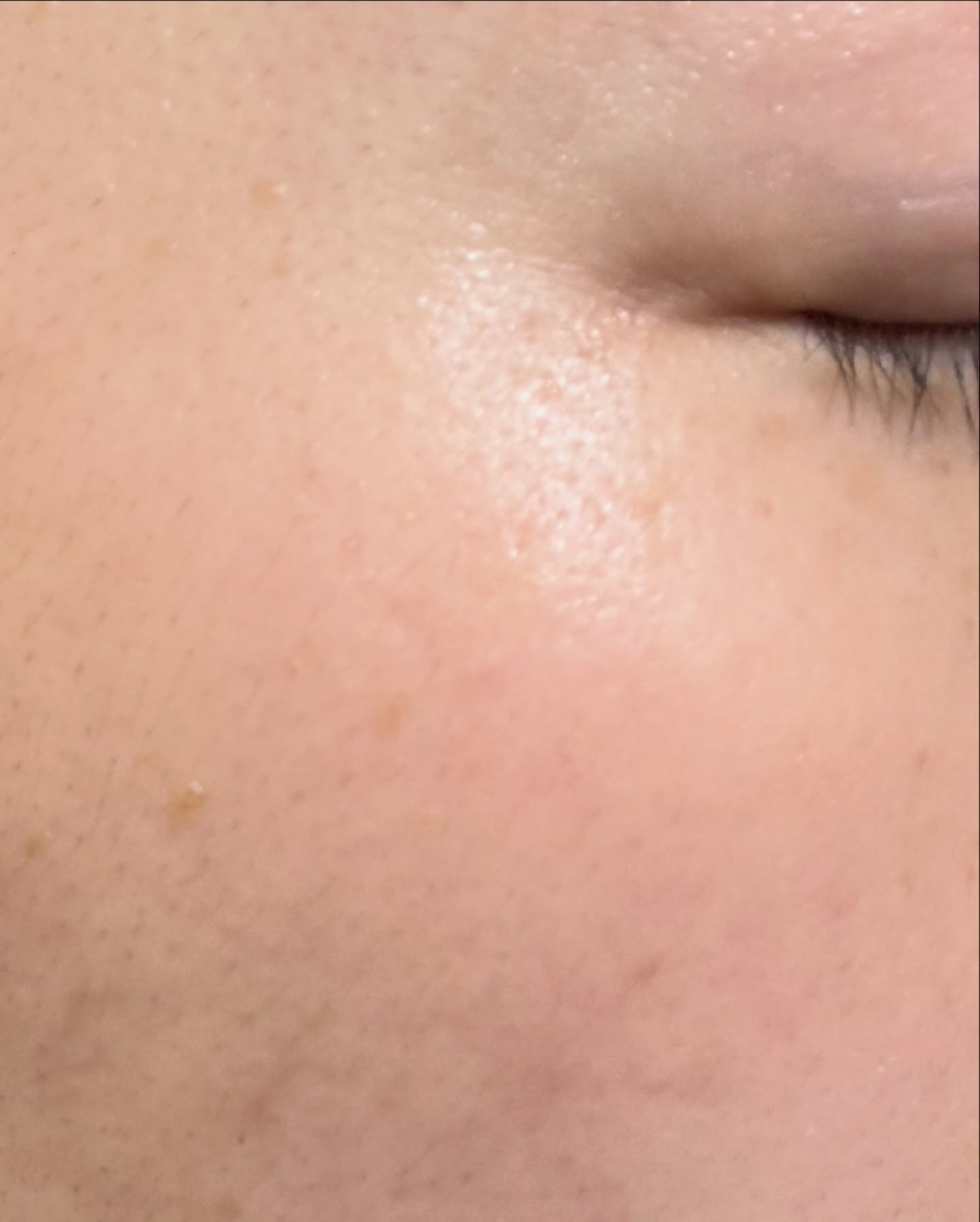 プラチナレーベル　ＶＣグルタチオンローション/プラチナレーベル/化粧水を使ったクチコミ（3枚目）