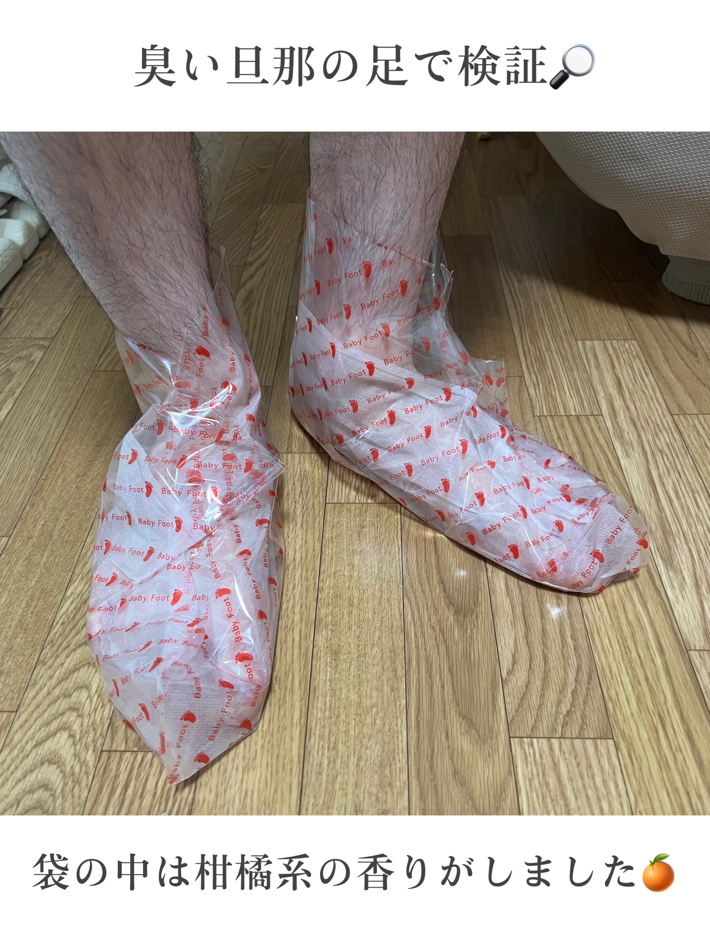 ベビーフット 重曹殺菌消毒洗浄剤/ベビーフット/レッグ・フットケアを使ったクチコミ（2枚目）