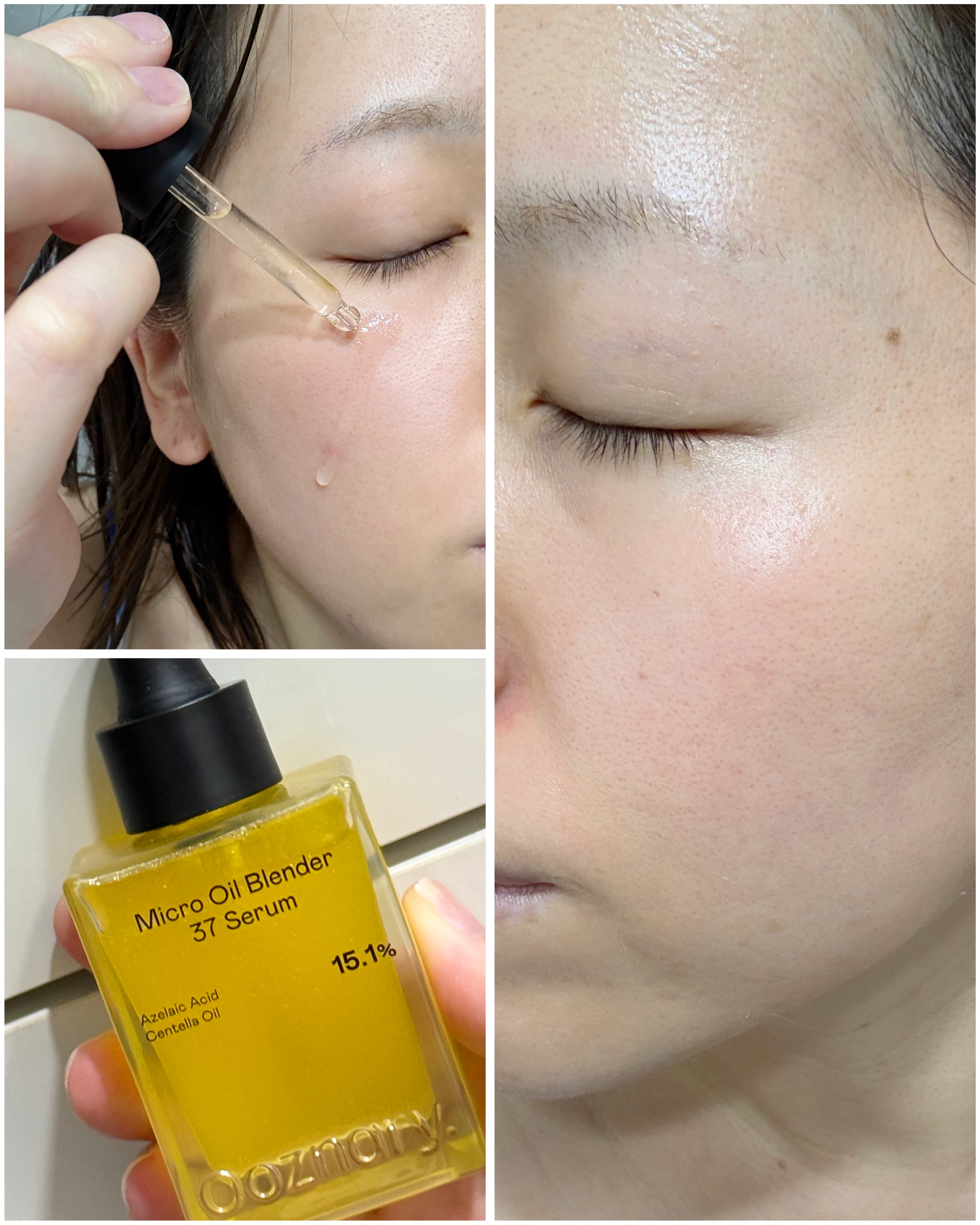 アゼライン酸CICA37セラム/オーズナリー/美容液を使ったクチコミ（3枚目）