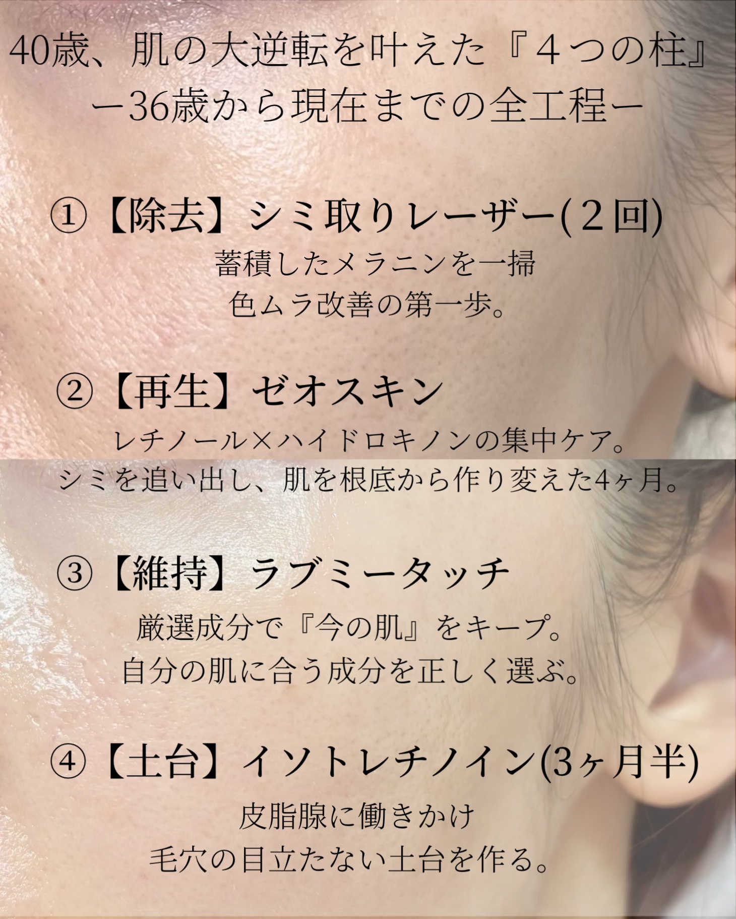 グラナクティブレチノイド7％ミルク/Lov me Touch/乳液を使ったクチコミ（2枚目）