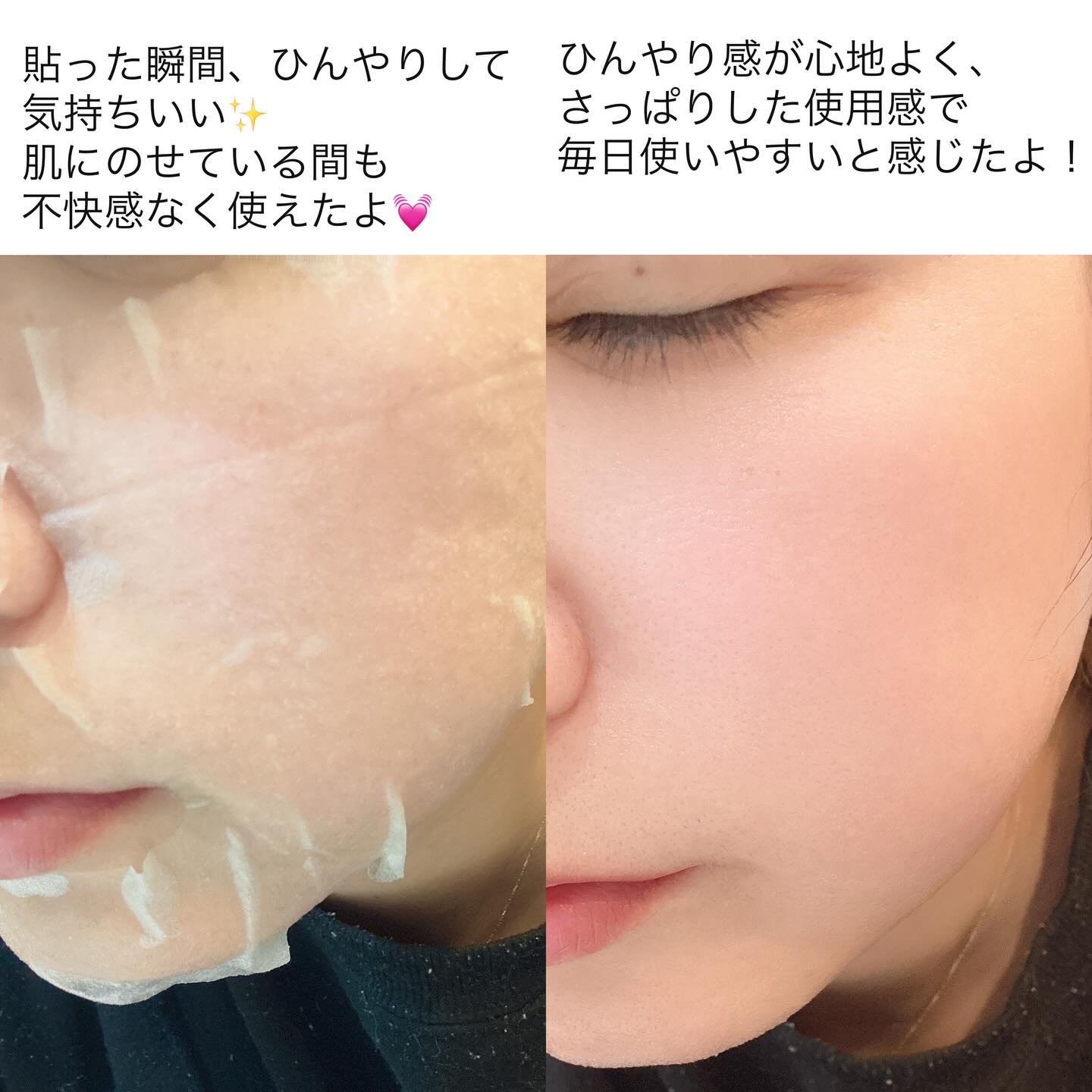 リアルセンテラシカデイリークイッククーリングマスク/PAPA RECIPE/シートマスク・パックを使ったクチコミ（3枚目）
