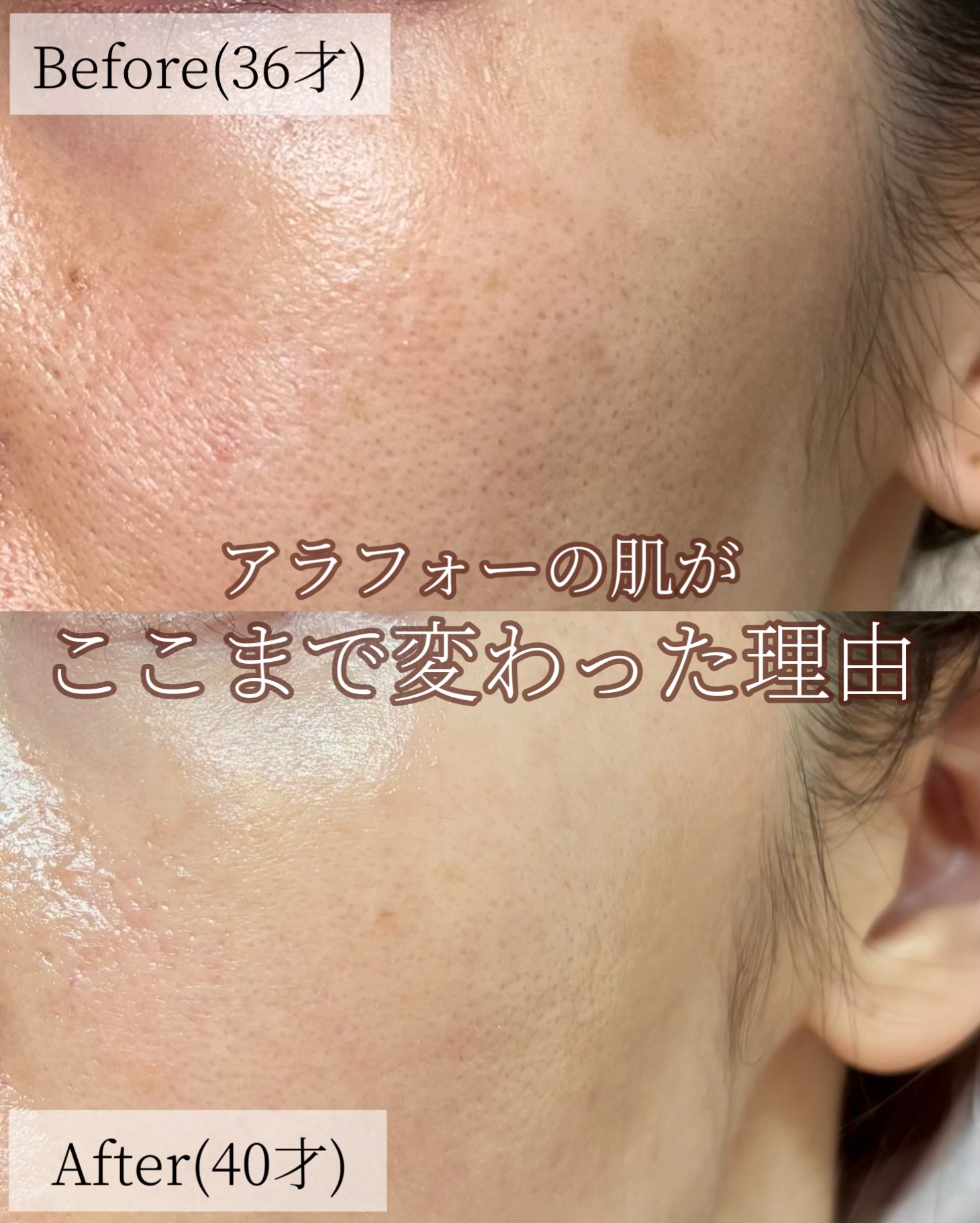 グラナクティブレチノイド7％ミルク/Lov me Touch/乳液を使ったクチコミ（1枚目）