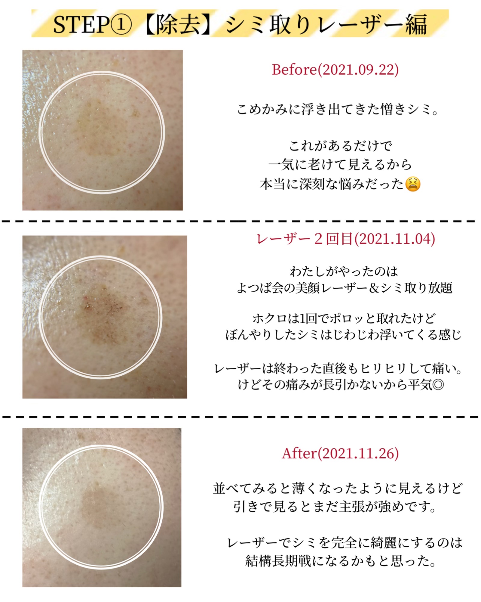 グラナクティブレチノイド7％ミルク/Lov me Touch/乳液を使ったクチコミ（3枚目）