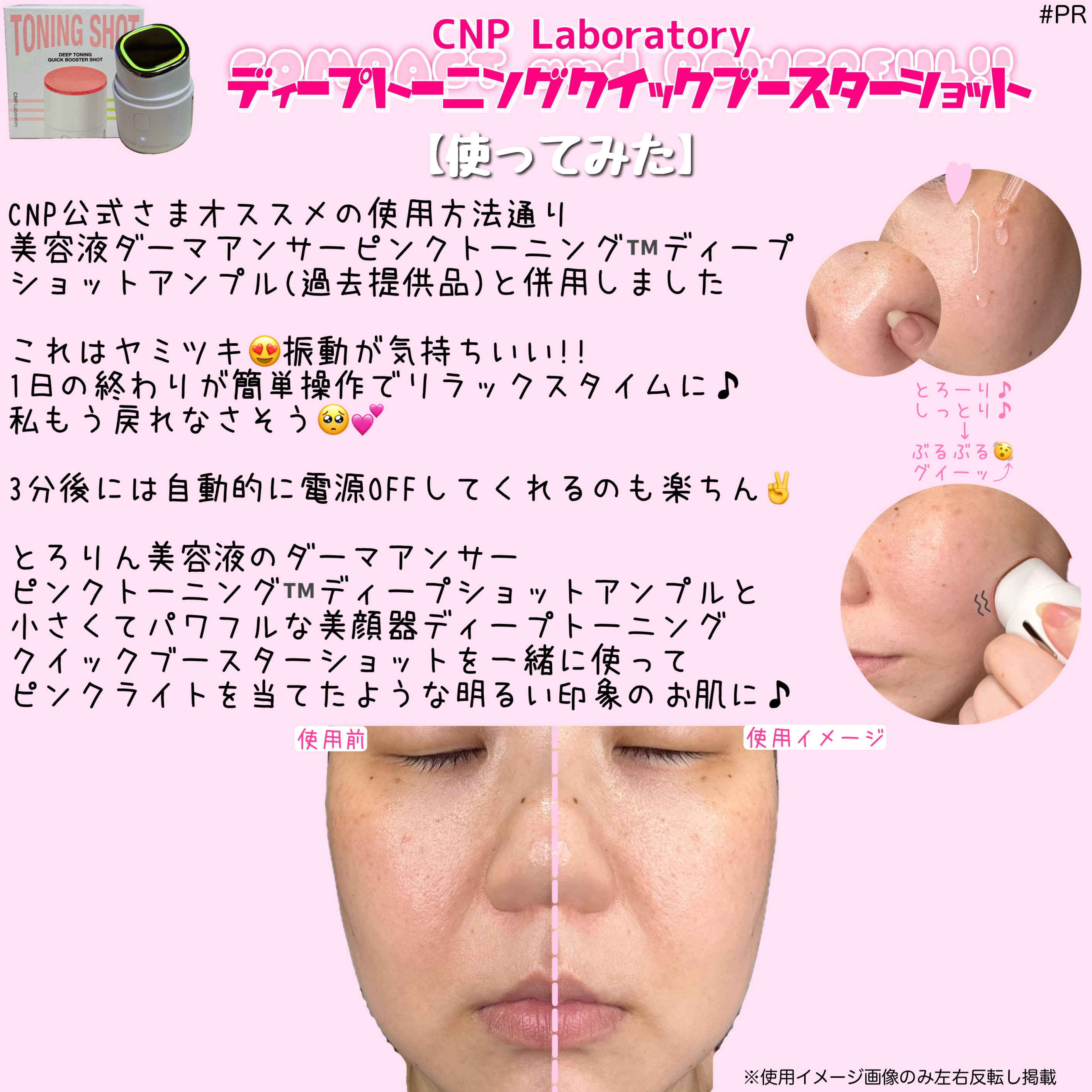 ディープトーニングクイックブースターショット/CNP Laboratory/美顔器・マッサージを使ったクチコミ（3枚目）