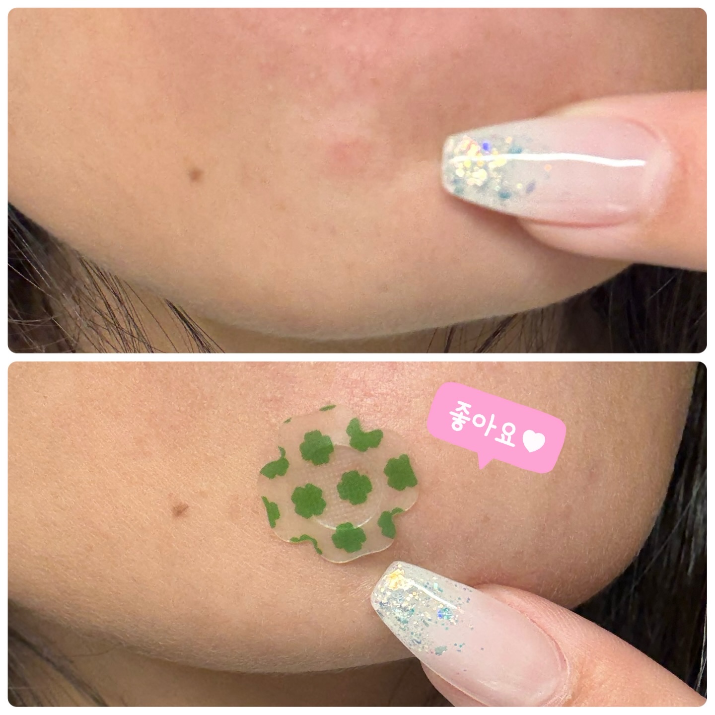 レチノール　シカ　フォーカシングパッチ/innisfree/にきびパッチを使ったクチコミ（3枚目）