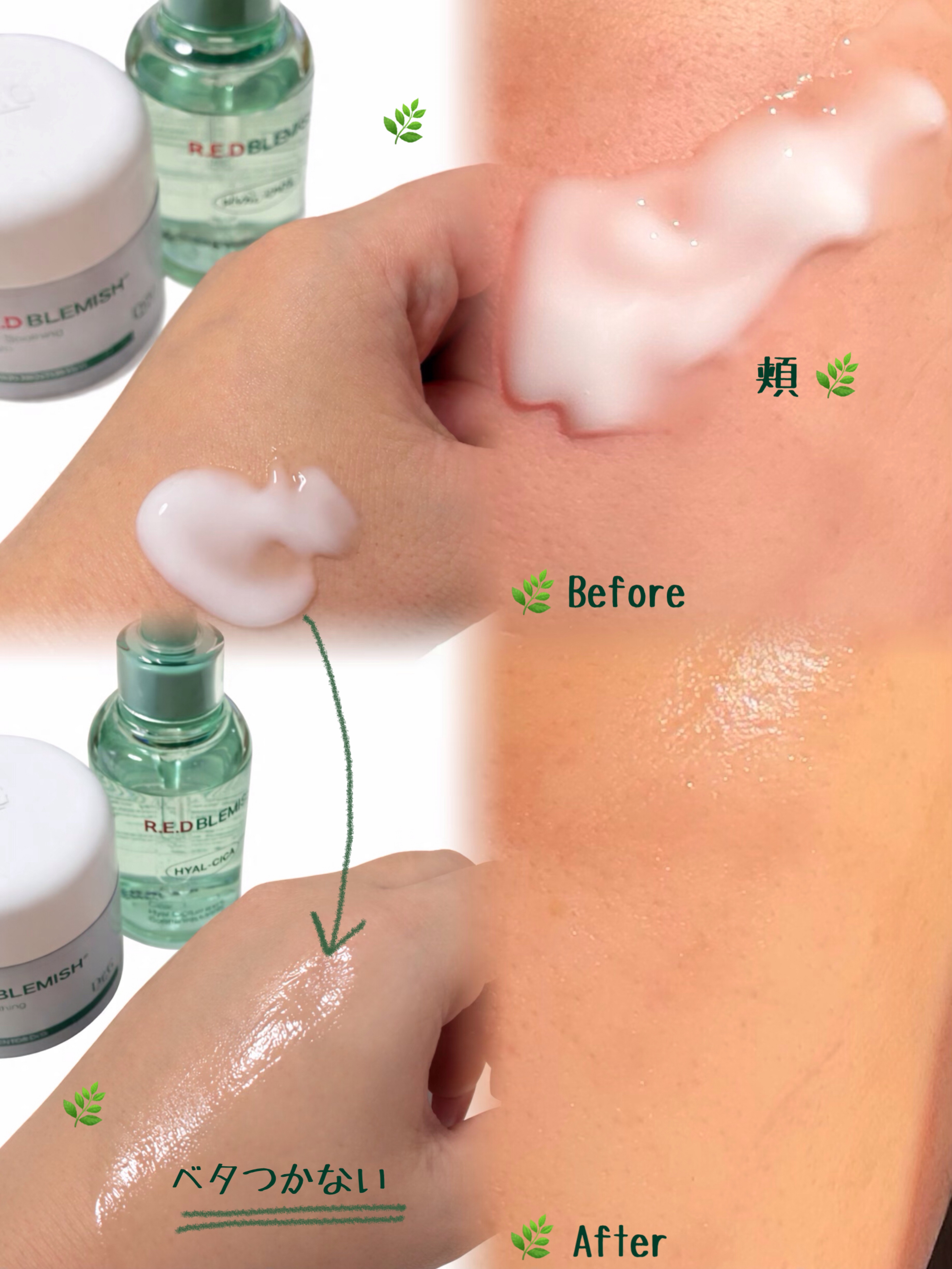 レッドブレミッシュ クリアスージングクリーム/Dr.G/フェイスクリームを使ったクチコミ（3枚目）