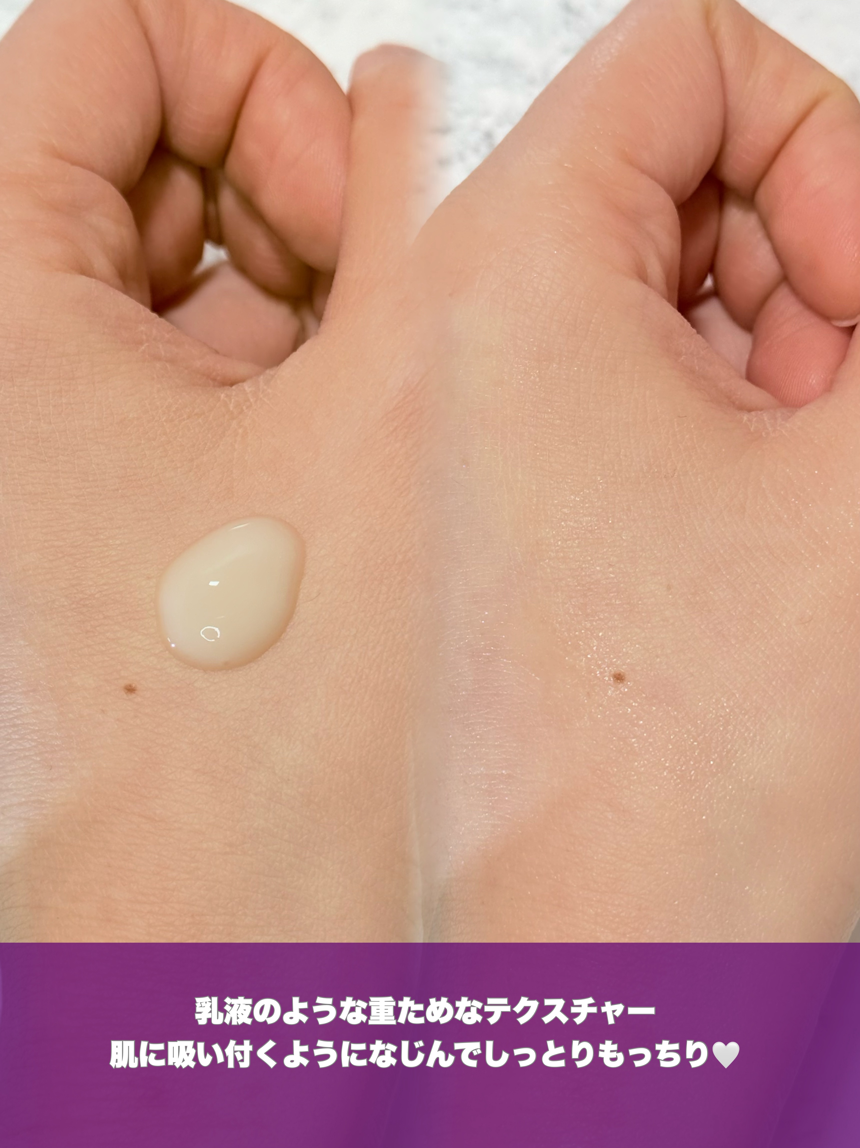 アットクリニックリンクルショットアンプル/DOMINAS/美容液を使ったクチコミ（3枚目）