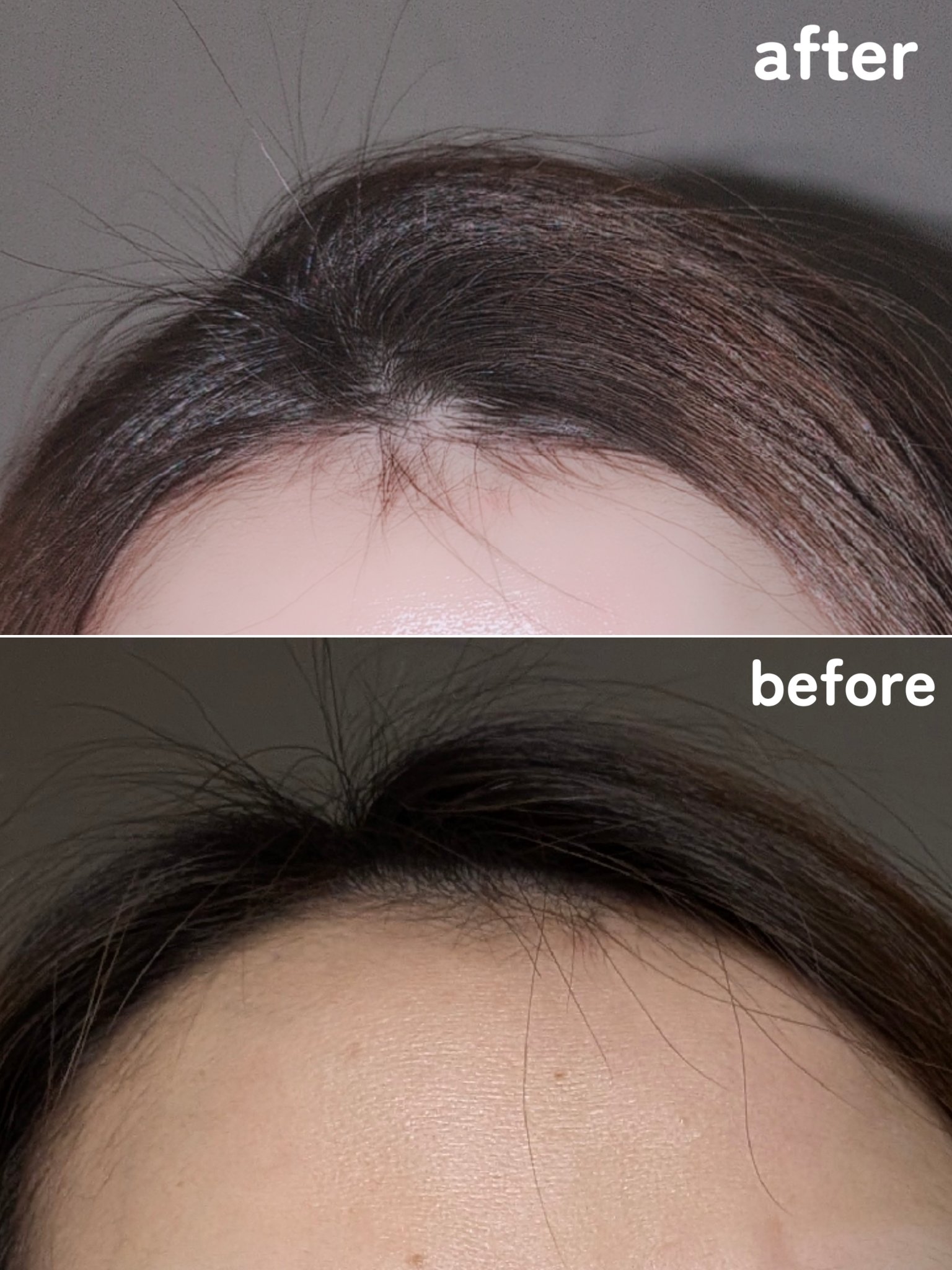 リリーイブ グローターン 3Dボリュームシャンプーのクチコミ「
\抜け毛・薄毛に悩んでない？！/
だったらリリーイブ♡グローターンシャンプー
¨ ❥˚ ¨ .....」（3枚目）