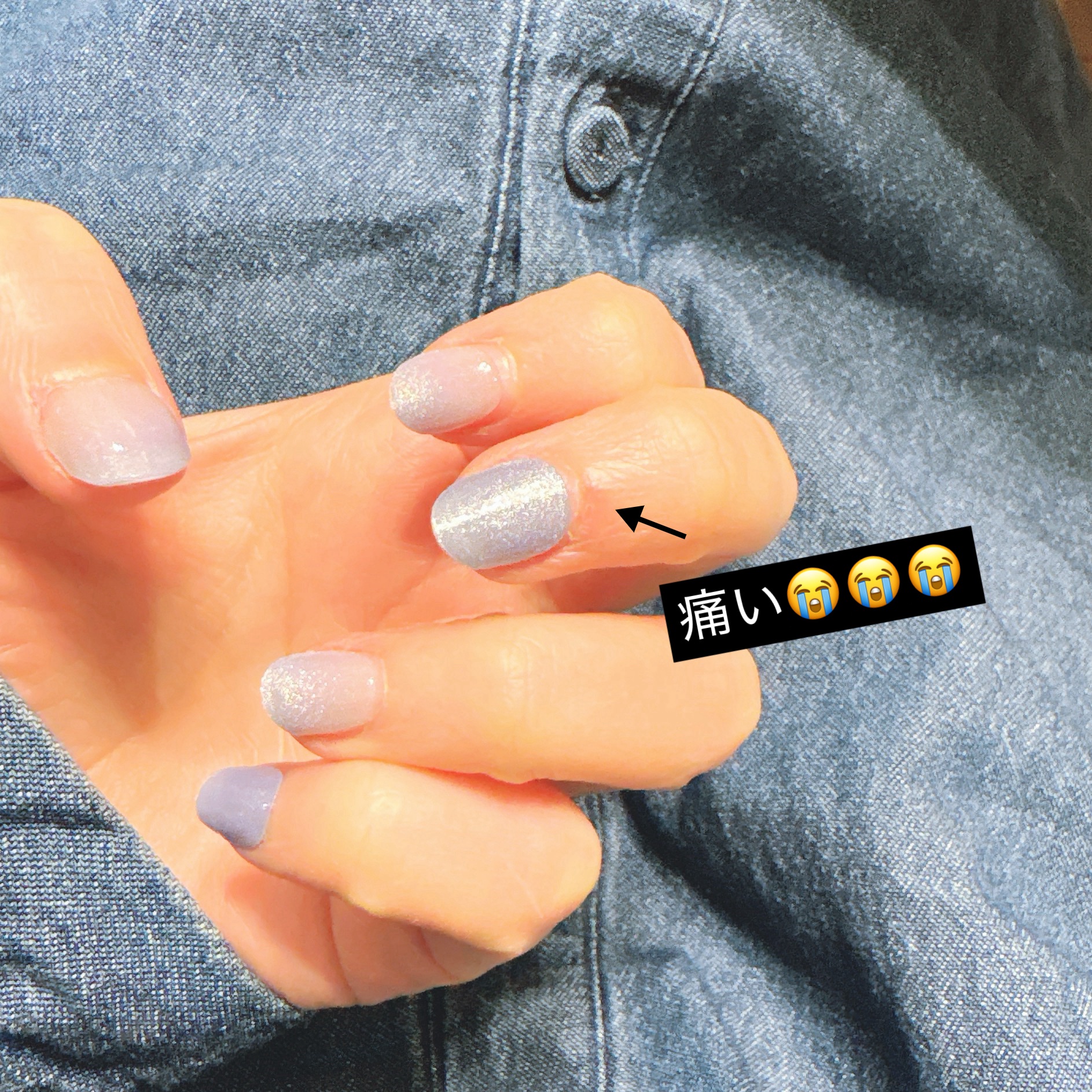 チュメキュア（医薬品）/小林製薬/その他を使ったクチコミ（2枚目）