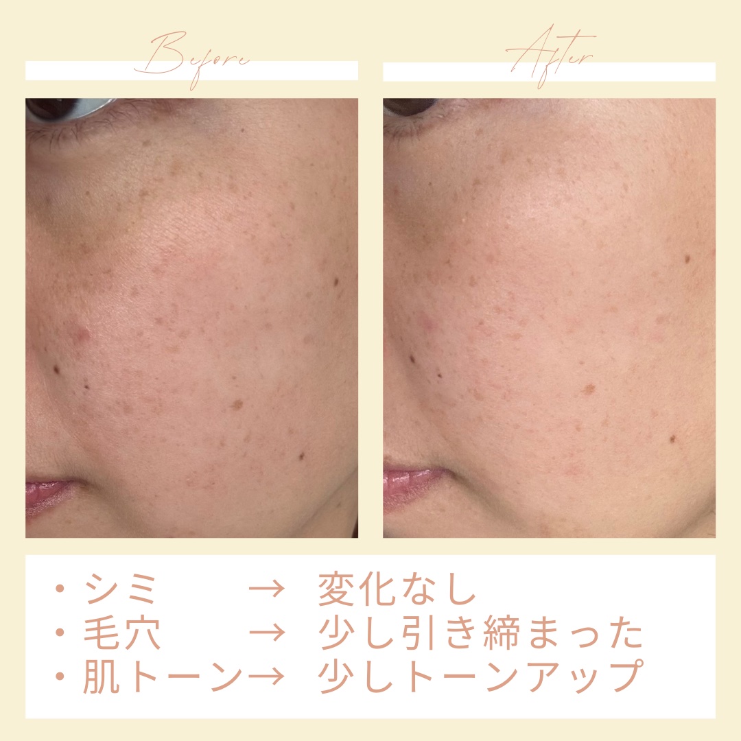 TBセラム/BRINGGREEN/美容液を使ったクチコミ（3枚目）