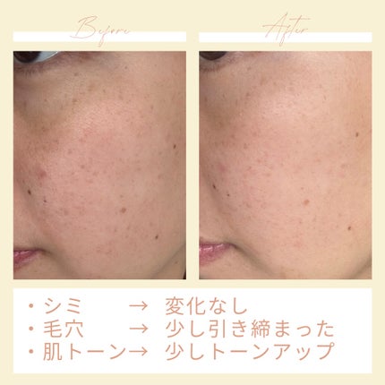 BRINGGREEN TBセラムのクチコミ「#BRINGGREEN
#ビタミンC美容液
#韓国コスメ
1週間使ってみて、肌トーンがあ.....」(3枚目)