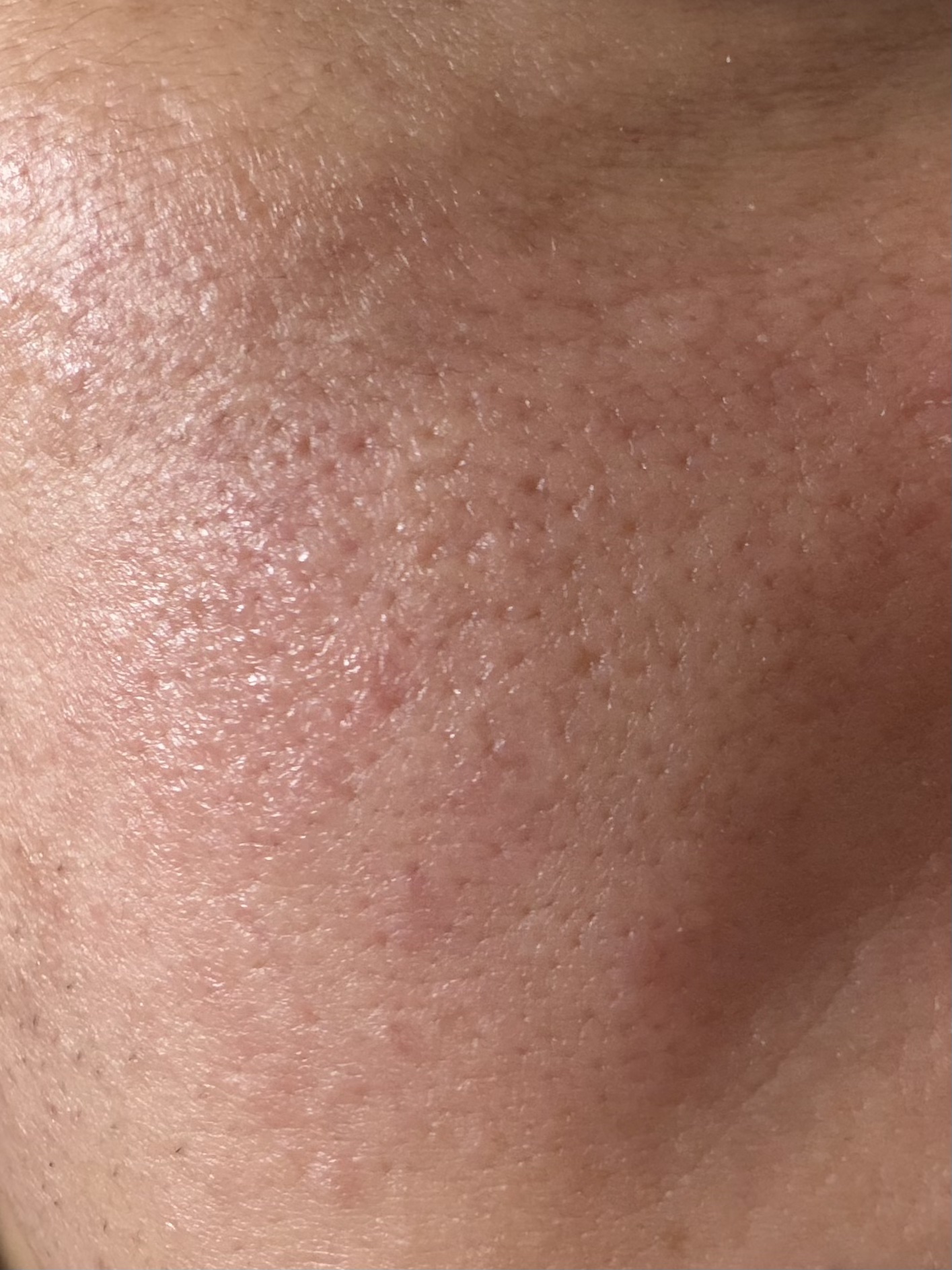 ACマグネシウムパッチ/スノーツープラス/シートマスク・パックを使ったクチコミ（3枚目）